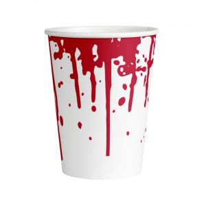 Vasos sangre